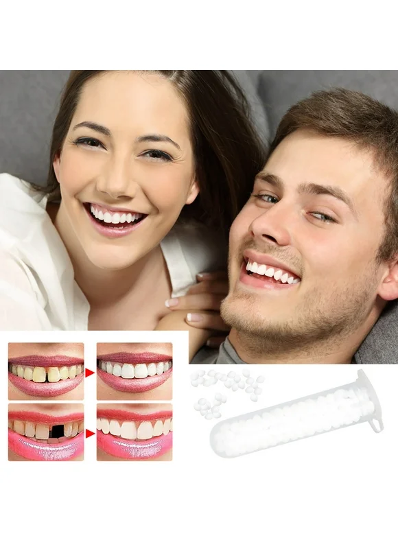 Cotonie Restoration Granules Restoration Kit Temporary Restoration Beads For Missing Teeth Beaded Teeth For A Confident Smile